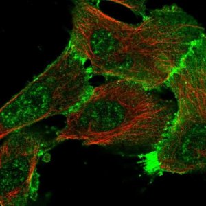 Anti-ERBIN antibody produced in rabbit 