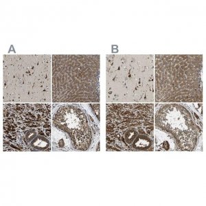 Anti-ERGIC1 antibody produced in rabbit HPA018666-100UL
