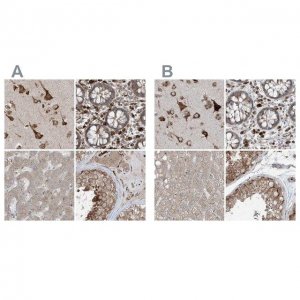 Anti-ERLEC1 antibody produced in rabbit 