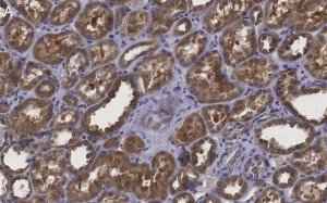 Anti-Erythropoietin Antibody, clone 6E5, ZooMAb� Rabbit Monoclonal 