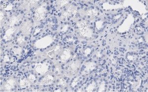 Anti-Erythropoietin Antibody, clone 6E5, ZooMAb� Rabbit Monoclonal 