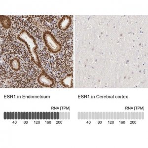 Anti-ESR1 antibody produced in rabbit 