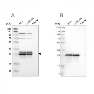 Anti-ETFB antibody produced in rabbit 
