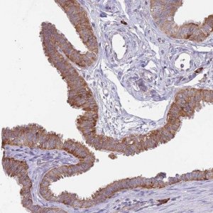 Anti-EXOSC8 antibody produced in rabbit HPA039702-100UL