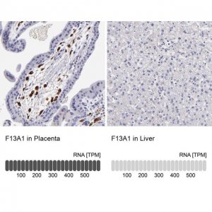 Anti-F13A1 antibody produced in rabbit 