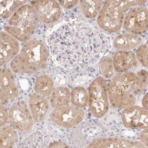 Anti-FABP1 antibody produced in rabbit 