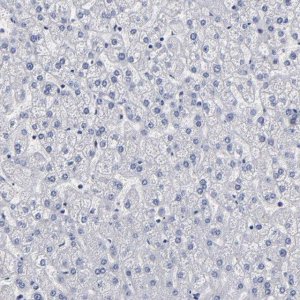 Anti-FABP4 antibody produced in rabbit 
