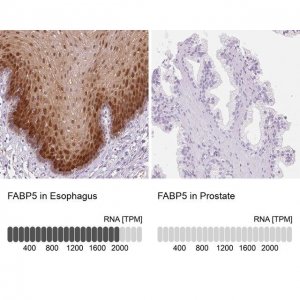 Anti-FABP5 antibody produced in rabbit 