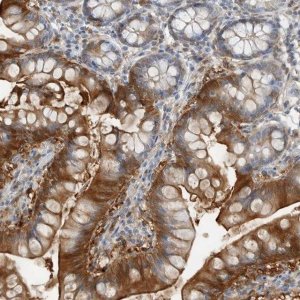 Anti-FABP6 antibody produced in rabbit 