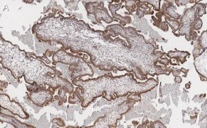 Anti-FAK Antibody, clone 1D14 ZooMAb� Rabbit Monoclonal 