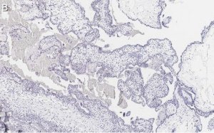 Anti-FAK Antibody, clone 1D14 ZooMAb� Rabbit Monoclonal 