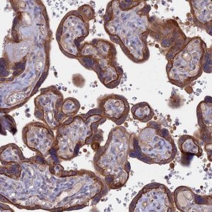 Anti-FAM126A antibody produced in rabbit 