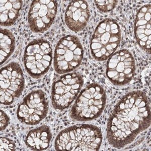 Anti-FAM13C antibody produced in rabbit 