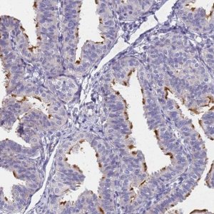 Anti-FAM166B antibody produced in rabbit 
