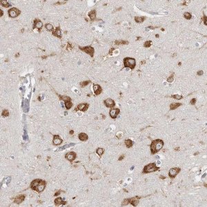 Anti-FAM167B antibody produced in rabbit HPA029398-100UL