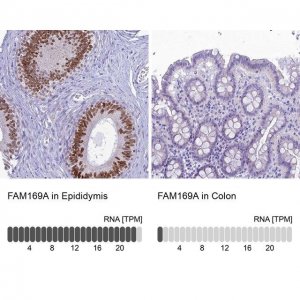 Anti-FAM169A antibody produced in rabbit 