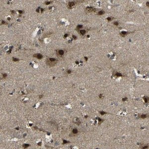 Anti-FAM172A antibody produced in rabbit 