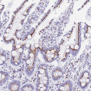 Anti-FAM3C antibody produced in rabbit 