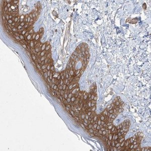 Anti-FAM83B antibody produced in rabbit 