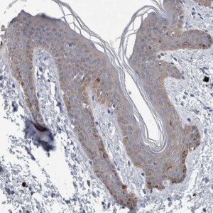 Anti-FAM83H antibody produced in rabbit HPA024505-100UL