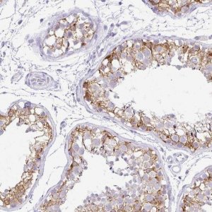 Anti-FATE1 antibody produced in rabbit 