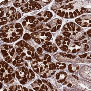 Anti-FBXO33 antibody produced in rabbit HPA046657-100UL