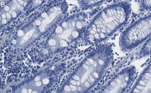 Anti-FBXO38 Antibody, clone 1I18 ZooMAb� Rabbit Monoclonal 