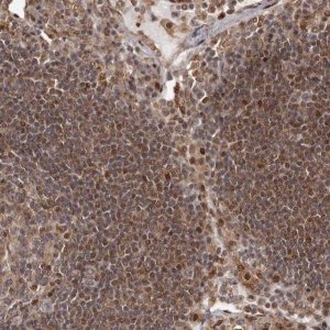 Anti-FBXO5 antibody produced in rabbit 