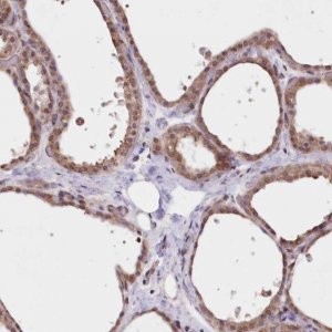 Anti-FCHO2 antibody produced in rabbit 