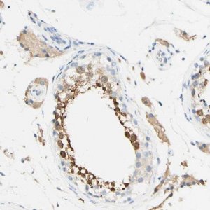 Anti-FGF4 antibody produced in rabbit 