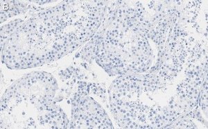 Anti-FKBP52 Antibody, clone 4H21 ZooMAb� Rabbit Monoclonal 