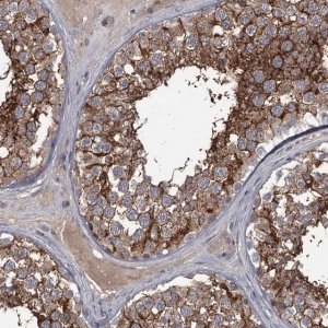 Anti-FLVCR2 antibody produced in rabbit 