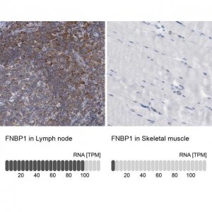 Anti-FNBP1 