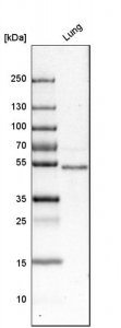 Anti-FOXF1 antibody produced in rabbit HPA028886-100UL