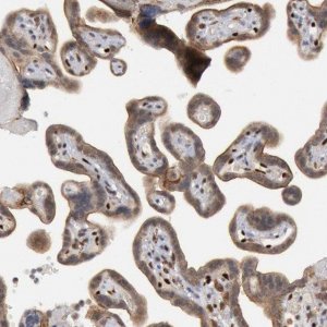 Anti-FOXO1 antibody produced in rabbit 