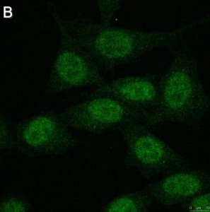 Anti-FoxP3 Antibody, clone 4J2 ZooMAb� Rabbit Monoclonal 