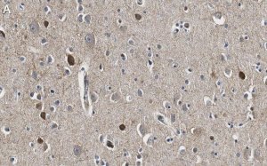 Anti-GAD67 Antibody, clone 4B5 ZooMAb� Rabbit Monoclonal 