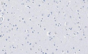 Anti-GAD67 Antibody, clone 4B5 ZooMAb� Rabbit Monoclonal 