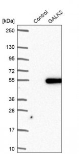 Anti-GALK2 antibody produced in rabbit HPA043564-100UL