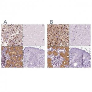 Anti-GALM antibody produced in rabbit HPA035473-100UL