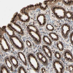 Anti-GALNT3 antibody produced in rabbit 