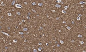 Anti-GAP43 Antibody, clone 1D6 , ZooMAb� Rabbit Monoclonal 