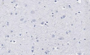 Anti-GAP43 Antibody, clone 1D6 , ZooMAb� Rabbit Monoclonal 