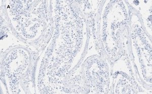Anti-GAPDH Antibody, clone 10B13, ZooMAb� Rabbit Monoclonal 