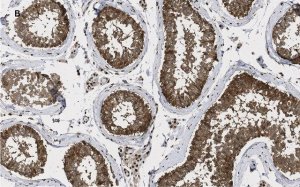 Anti-GAPDH Antibody, clone 10B13, ZooMAb� Rabbit Monoclonal 