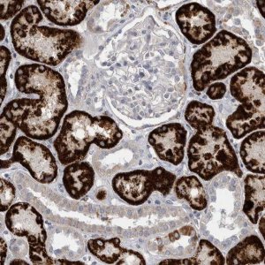 Anti-GATM antibody produced in rabbit 