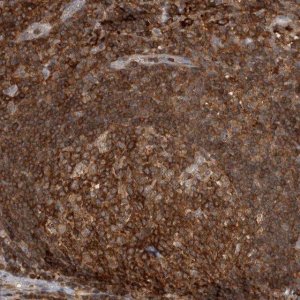 Anti-GFRA2 antibody produced in rabbit 