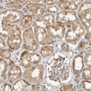 Anti-GINS4 antibody produced in rabbit HPA024663-100UL