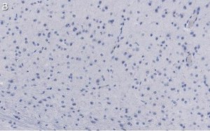 Anti-GluR1 Antibody, clone RH95 ZooMAb� Mouse Monoclonal 