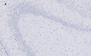 Anti-GluR2 Antibody, clone 1K4, ZooMAb� Rabbit Monoclonal 